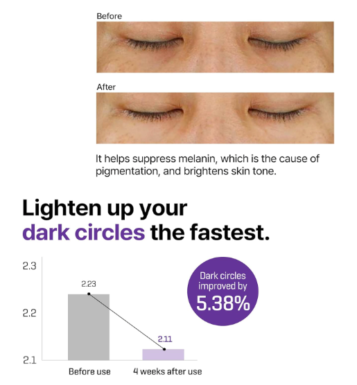 Some By Mi Retinol Intense Advanced Triple Action Eye Cream | 30ml | Mild Overnight Korean Anti-Aging Eye Cream | for Dark Circles & Fine Lines | Ideal for Retinol Beginners